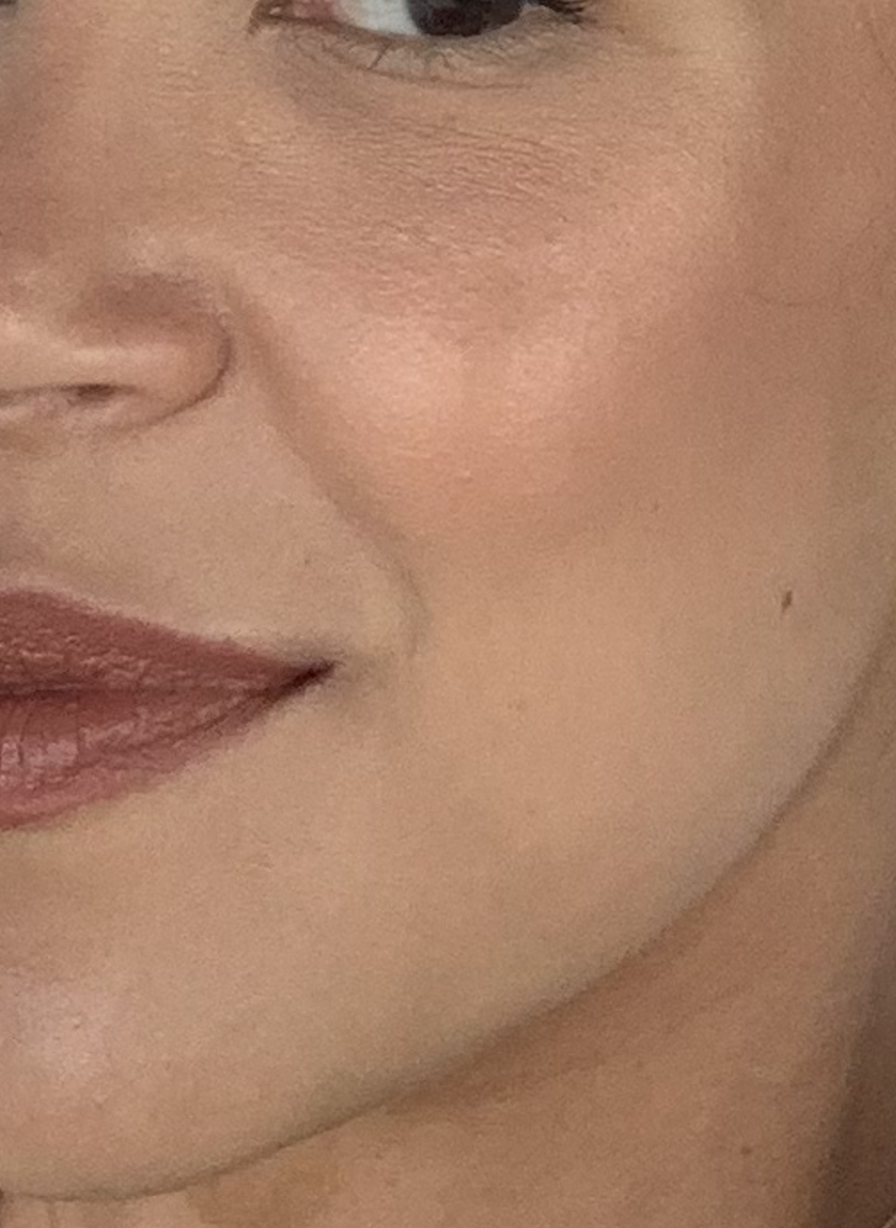 Skin close-up